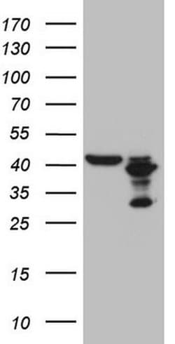 PLCXD1 Monoclonal Antibody (OTI2D7), TrueMAB , OriGene 100 &mu;L; Unconjugated:Antibodies,