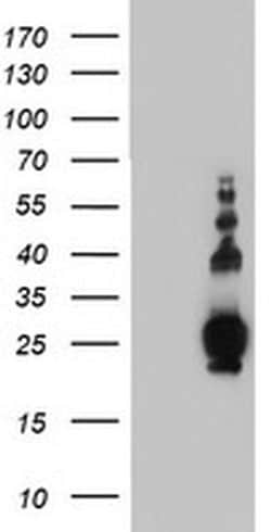 PLDN Monoclonal Antibody (OTI1E2), TrueMAB , OriGene 100 &mu;L; Unconjugated:Antibodies,
