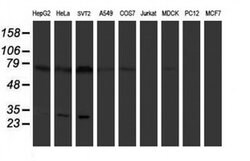 PLDN Monoclonal Antibody (OTI1H9), TrueMAB , OriGene 100 &mu;L; Unconjugated:Antibodies,