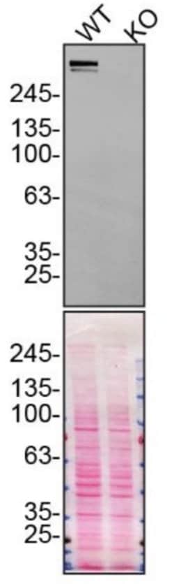 Invitrogen Plectin Recombinant Rabbit Monoclonal Antibody (SY29-04) 100
