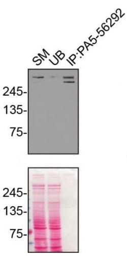 Invitrogen Plectin Polyclonal Antibody 100 &mu;L; Unconjugated:Antibodies,
