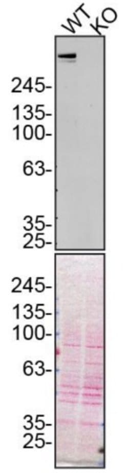 Invitrogen Plectin Polyclonal Antibody 100 &mu;L; Unconjugated:Antibodies,