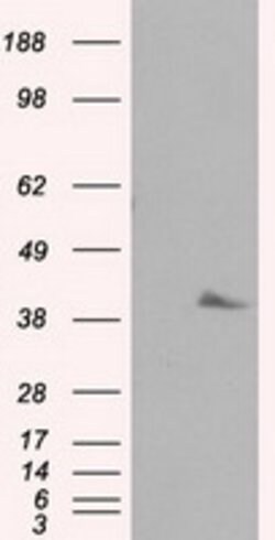 PLEK Mouse anti-Human, Clone: OTI2F10, lyophilized, TrueMAB 100 &mu;g | Buy Online | Origene Technologies | Fisher Scientific
