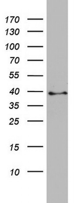 PLEK2 Monoclonal Antibody (OTI5D3), TrueMAB , OriGene 100 &mu;L; Unconjugated:Antibodies,