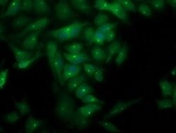 PLEKHA3 Mouse anti-Human, Clone: OTI2D1, lyophilized, TrueMAB 100 &mu;g;