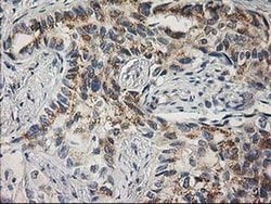 PLEKHA3 Monoclonal Antibody (OTI6E4), TrueMAB , OriGene 100 &mu;L; Unconjugated:Antibodies,