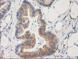 PLEKHA3 Monoclonal Antibody (OTI6E4), TrueMAB , OriGene 100 &mu;L; Unconjugated:Antibodies,