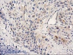 PLEKHA3 Mouse anti-Human, Clone: OTI5D11, liquid, TrueMAB 100 &mu;L; Unconjugated:Antibodies,