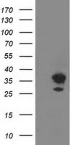 PLEKHA3 Mouse anti-Human, Clone: OTI2D1, lyophilized, TrueMAB 100 &mu;g;