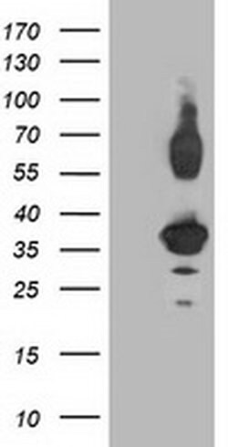 PLEKHA3 Monoclonal Antibody (OTI6E4), TrueMAB , OriGene 100 &mu;L; Unconjugated:Antibodies,