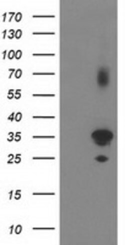 PLEKHA3 Mouse anti-Human, Clone: OTI5D11, lyophilized, TrueMAB 100 &mu;g;