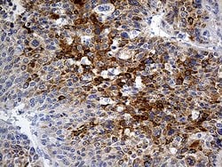 PLG Monoclonal Antibody (OTI4F5), TrueMAB , OriGene:Antibodies:Primary