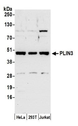 PLIN3 Polyclonal Antibody, Bethyl Laboratories 20 &mu;L; Unconjugated:Antibodies,