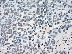 PLK1 Mouse anti-Human, Clone: OTI5C1, liquid, TrueMAB 100 &mu;L | Buy Online | Origene Technologies | Fisher Scientific