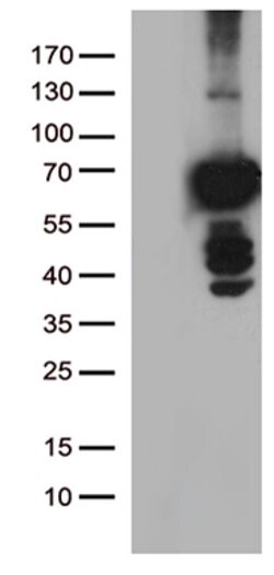 PLK1 Mouse anti-Human, Clone: OTI3F12, lyophilized, TrueMAB 100 &mu;g;