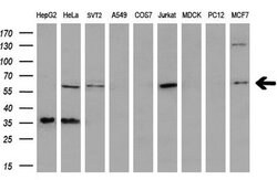 PLK1 Mouse anti-Human, Clone: OTI3F12, lyophilized, TrueMAB 100 &mu;g;