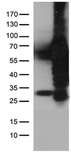PLK1 Mouse anti-Canine, Human, Clone: OTI8C12, lyophilized, TrueMAB 100