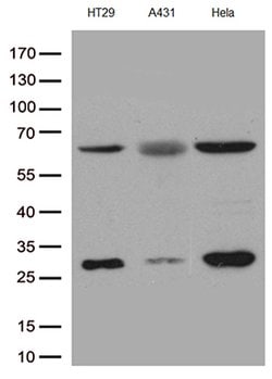 PLK1 Mouse anti-Canine, Human, Clone: OTI8C12, lyophilized, TrueMAB 100