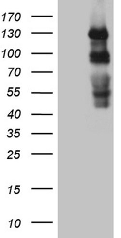 PLK4 Monoclonal Antibody (OTI2H5), TrueMAB , OriGene 100 &mu;L; Unconjugated:Antibodies,