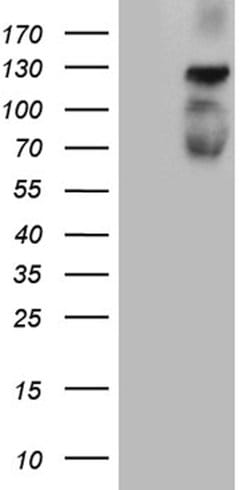 PLK4 Mouse anti-Human, Clone: OTI2A12, lyophilized, TrueMAB 100 &mu;g;