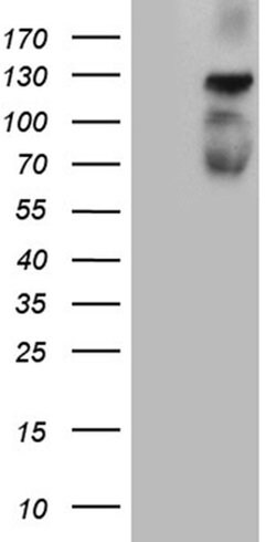 PLK4 Monoclonal Antibody (OTI2A12), TrueMAB , OriGene 30 &mu;L; Unconjugated:Antibodies,