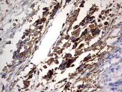 PLOD2 Mouse anti-Human, Clone: OTI7G5, lyophilized, TrueMAB 100 &mu;g;