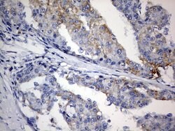 PLOD2 Mouse anti-Human, Clone: OTI7G5, lyophilized, TrueMAB 100 &mu;g;