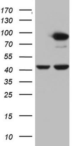 PLOD2 Mouse anti-Human, Clone: OTI7G5, lyophilized, TrueMAB 100 &mu;g;