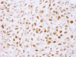 PLRG1 Polyclonal Antibody, Bethyl Laboratories 100 &mu;L; Unconjugated:Antibodies,