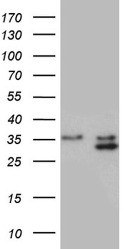 PLSCR2 Monoclonal Antibody (OTI7A5), TrueMAB , OriGene 100 &mu;L; Unconjugated:Antibodies,