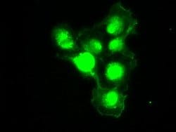 PMEL Mouse anti-Canine, Human, Rat, Clone: OTI8A4, lyophilized, TrueMAB