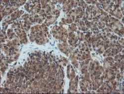 PMEL Mouse anti-Canine, Human, Rat, Clone: OTI8A4, lyophilized, TrueMAB
