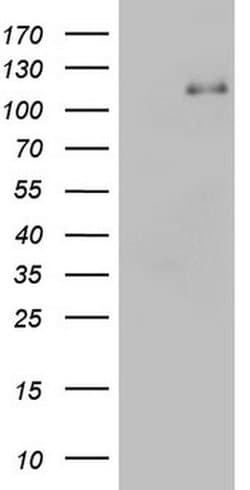 PMEL Monoclonal Antibody (OTI1E5), TrueMAB , OriGene 100 &mu;L; Unconjugated:Antibodies,