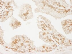 PML Rabbit anti-Human, Polyclonal, Bethyl Laboratories 100 &mu;L; Unconjugated:Antibodies,