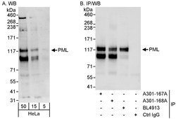 PML Rabbit anti-Human, Polyclonal, Bethyl Laboratories 100 &mu;L; Unconjugated:Antibodies,