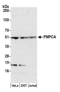 PMPCA Polyclonal Antibody, Bethyl Laboratories 20 &mu;L; Unconjugated:Antibodies,