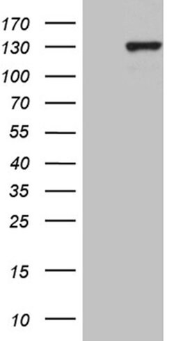 PMS1 Mouse anti-Human, Clone: OTI5E10, lyophilized, TrueMAB 100 &mu;g;