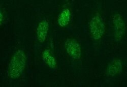 PMS2 Mouse anti-Human, Clone: OTI4B7, lyophilized, TrueMAB 100 &mu;g; Unconjugated:Antibodies,