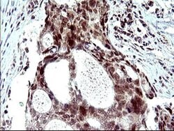 PMS2 Mouse anti-Human, Clone: OTI2G5, liquid, TrueMAB 30 &mu;L; Unconjugated:Antibodies,