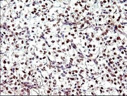 PMS2 Mouse anti-Human, Clone: OTI2G5, liquid, TrueMAB 30 &mu;L; Unconjugated:Antibodies,