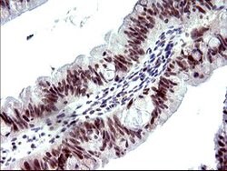 PMS2 Mouse anti-Human, Clone: OTI4B7, lyophilized, TrueMAB 100 &mu;g; Unconjugated:Antibodies,