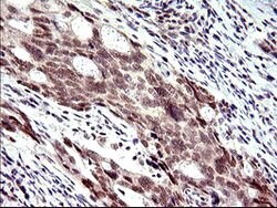 PMS2 Mouse anti-Human, Clone: OTI4B7, lyophilized, TrueMAB 100 &mu;g; Unconjugated:Antibodies,