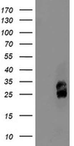 PMVK Monoclonal Antibody (OTI2D1), TrueMAB , OriGene 100 &mu;L; Unconjugated:Antibodies,