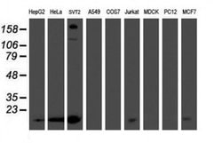 PMVK Monoclonal Antibody (OTI2D1), TrueMAB , OriGene 100 &mu;L; Unconjugated:Antibodies,