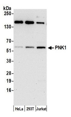 PNK1 Rabbit anti-Human, Polyclonal, Bethyl Laboratories 100 &mu;L; Unconjugated:Antibodies,