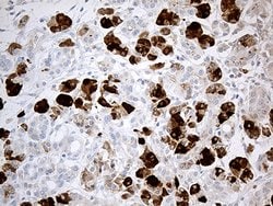 PNLIP Monoclonal Antibody (OTI5B9), TrueMAB , OriGene:Antibodies:Primary