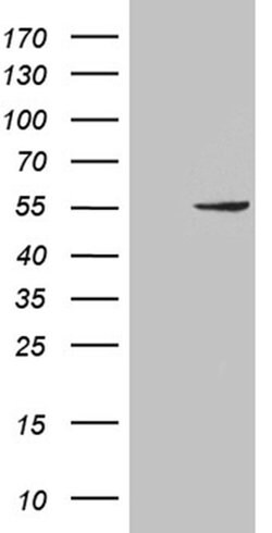 PNLIP Monoclonal Antibody (OTI5B9), TrueMAB , OriGene:Antibodies:Primary