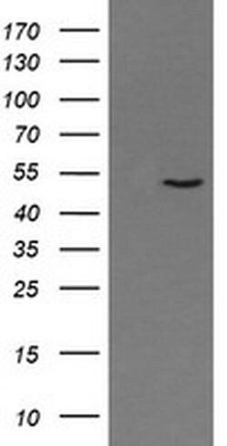 PNMA3 Monoclonal Antibody (OTI2E6), TrueMAB , OriGene 100 &mu;L; Unconjugated:Antibodies,