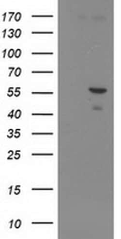PNMA3 Monoclonal Antibody (OTI2D3), TrueMAB , OriGene 100 &mu;L; Unconjugated:Antibodies,