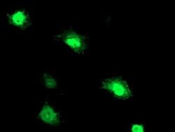PNMT Monoclonal Antibody (OTI2F3), TrueMAB , OriGene 100 &mu;L; Unconjugated:Antibodies,